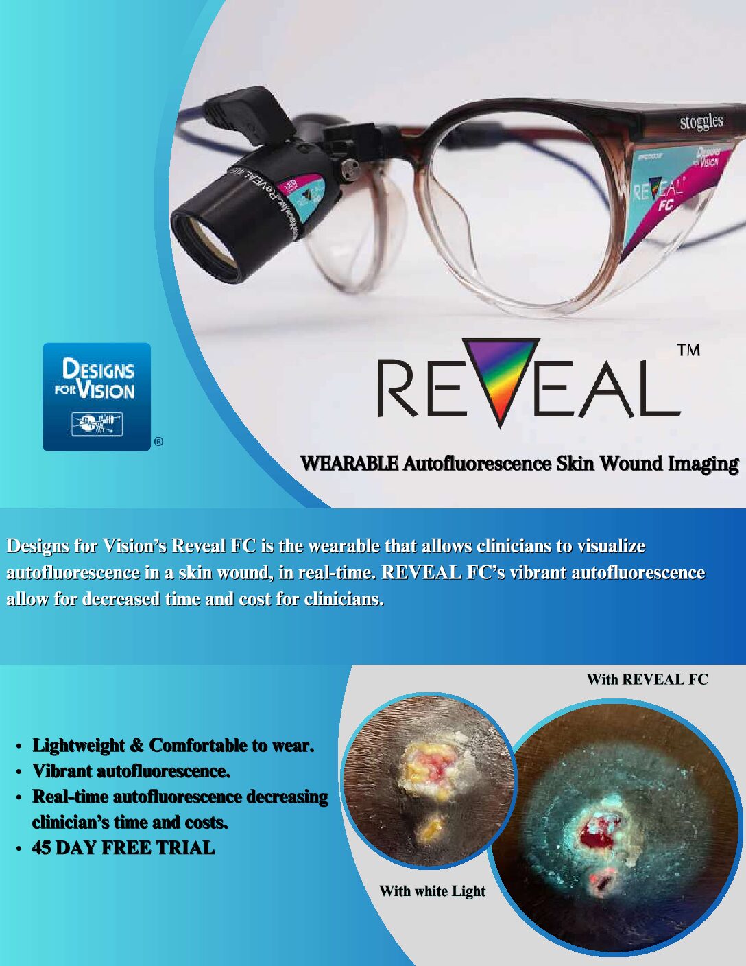 REVEAL WC Autofluorescence Skin Wound Imaging